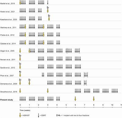 Two-Weekly High-Dose-Rate Brachytherapy Boost After External Beam Radiotherapy for Localized Prostate Cancer: Long-Term Outcome and Toxicity Analysis